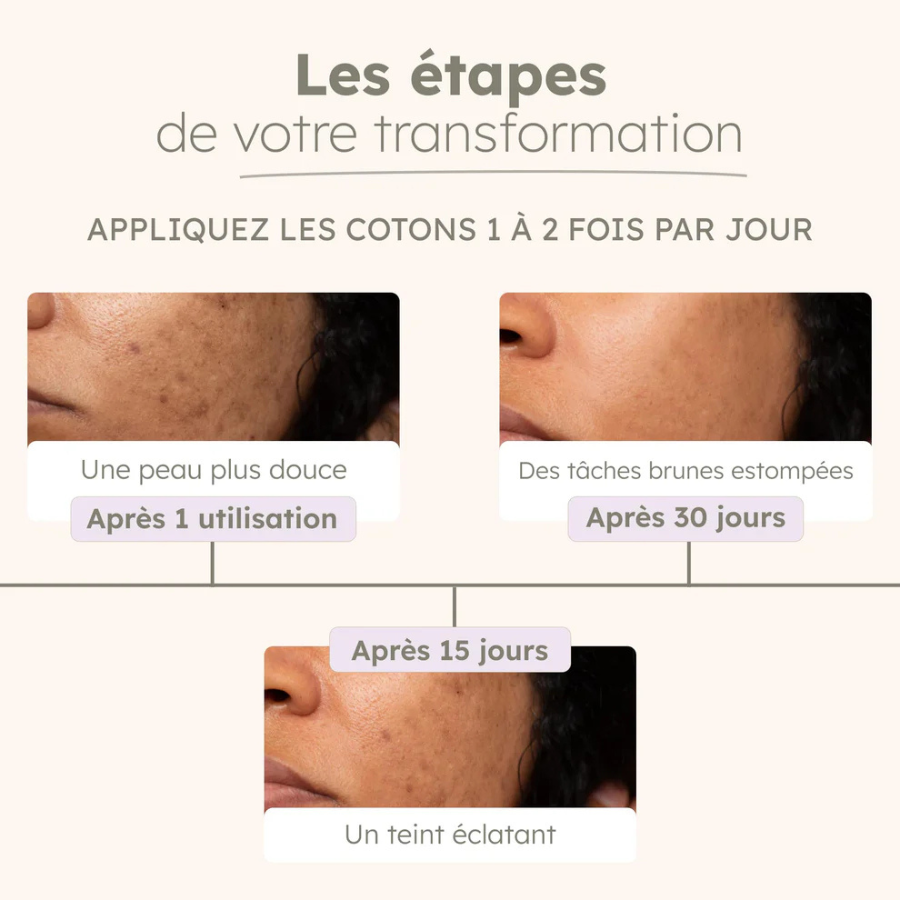 Cotons au Curcuma | Anti-imperfections - 40 cotons