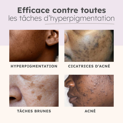 Cotons au Curcuma | Anti-imperfections - 40 cotons